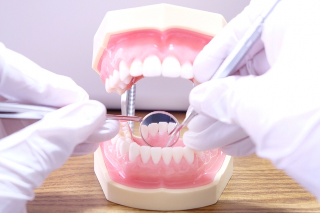 歯科検診、メンテナンス